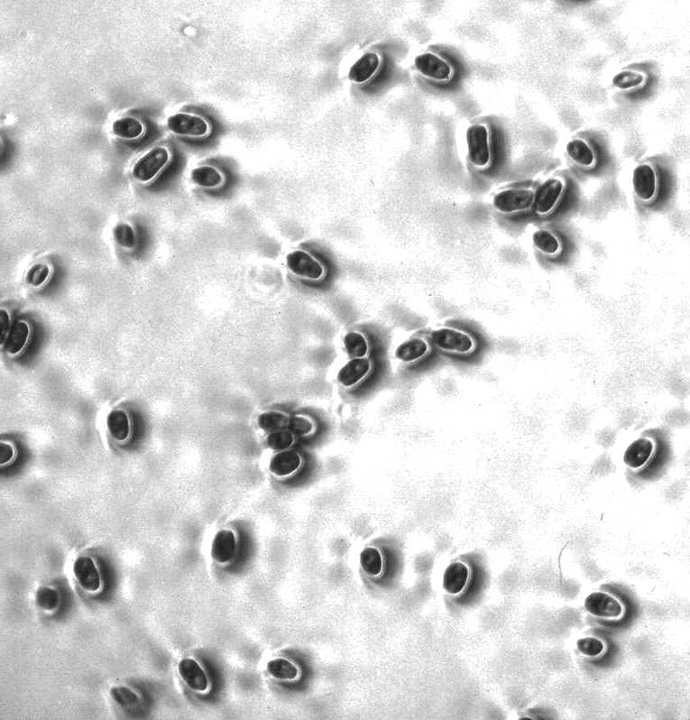 Candida albicans yeast